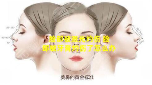 脸部被激光灼伤 脸部被牙膏灼伤了怎么办